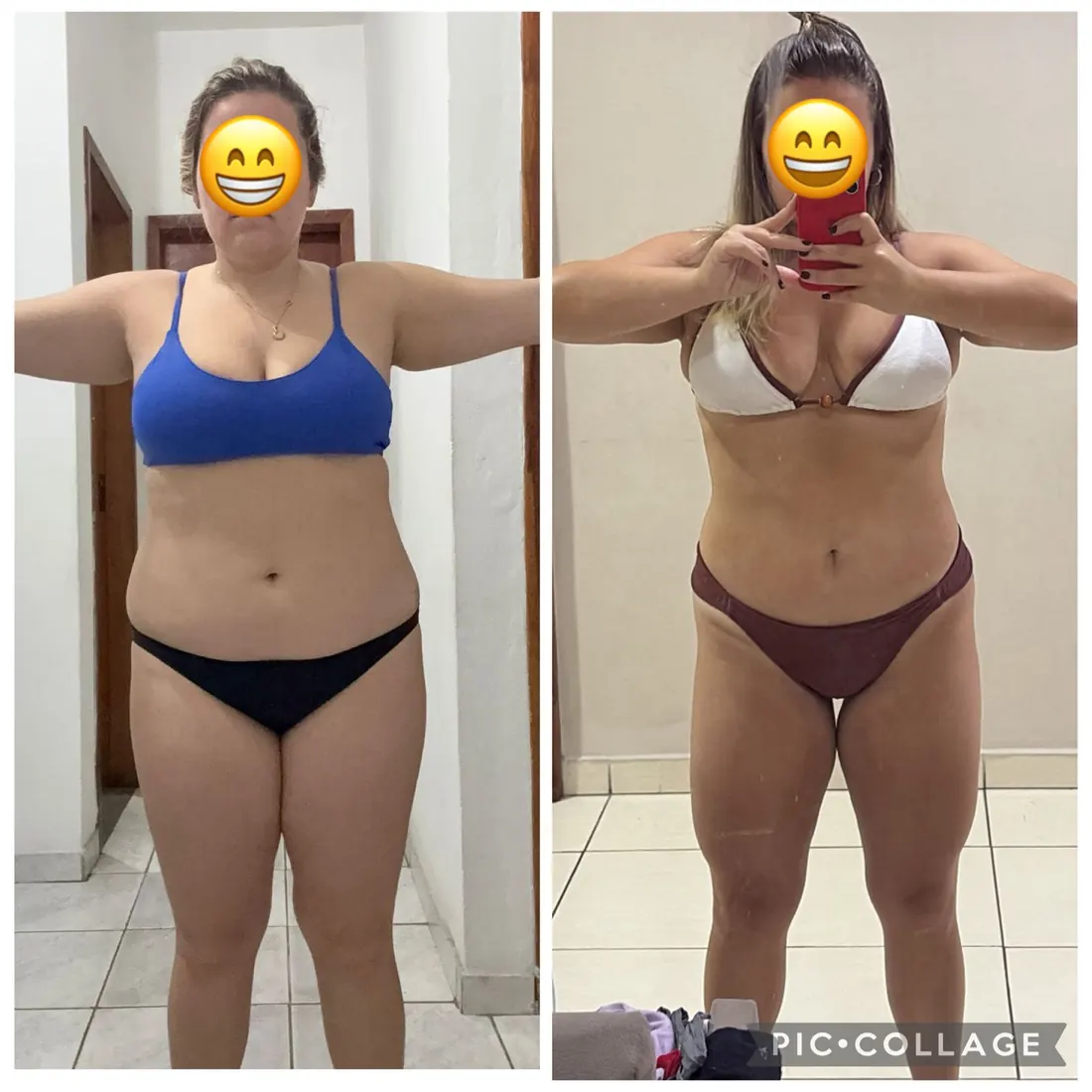 Antes e depois de aluna, vista frontal